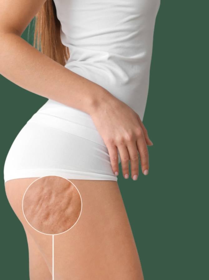 young woman in white outfit with cellulite young woman in white outfit with cellulite